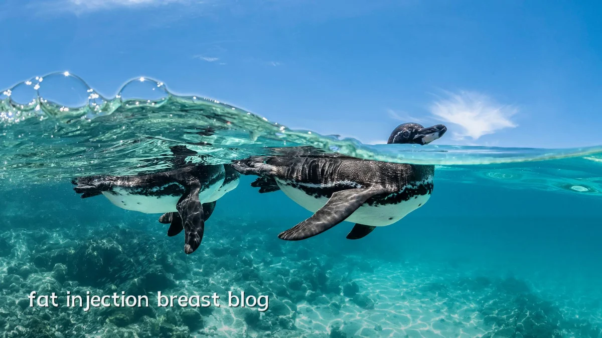 fat injection breast blog