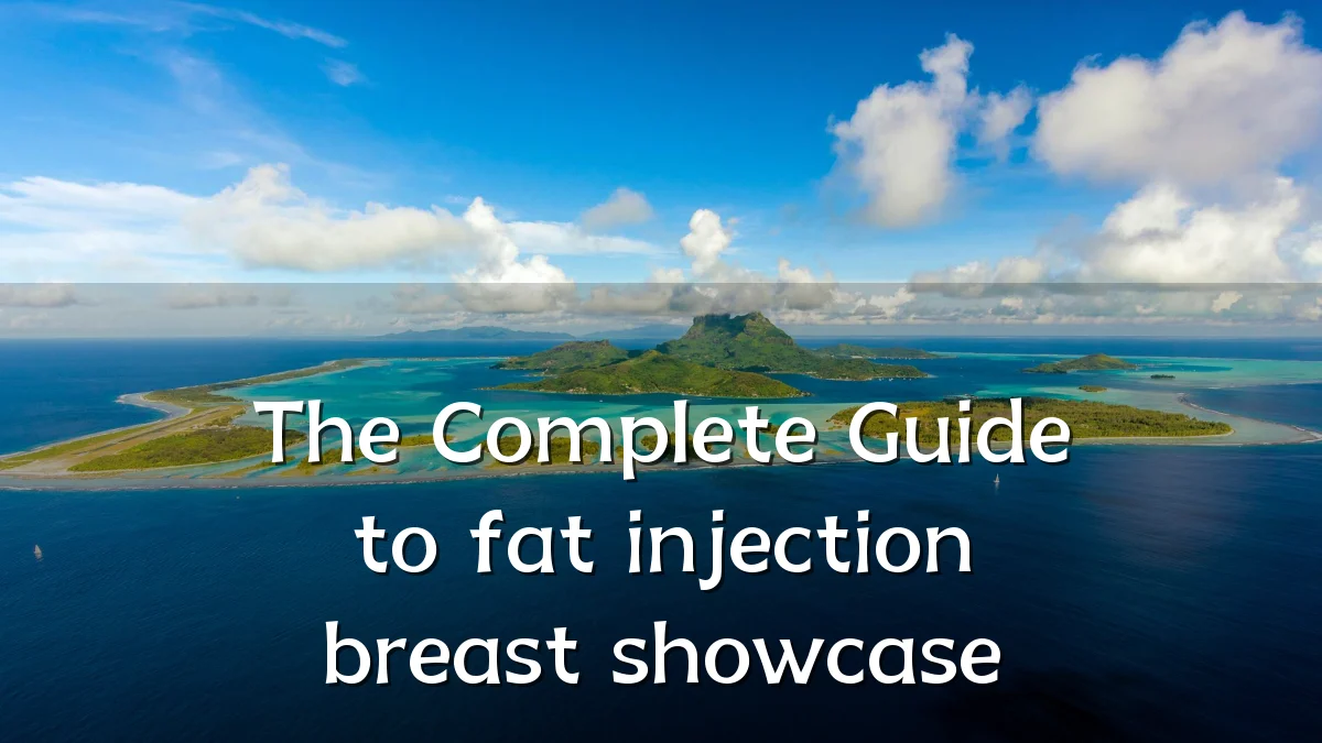 The Complete Guide to fat injection breast showcase